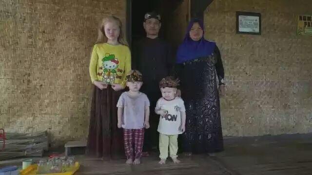 Kisah 'Walanda Sunda' di Kampung Albino Ciburuy