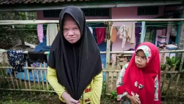 Kisah 'Walanda Sunda' di Kampung Albino Ciburuy