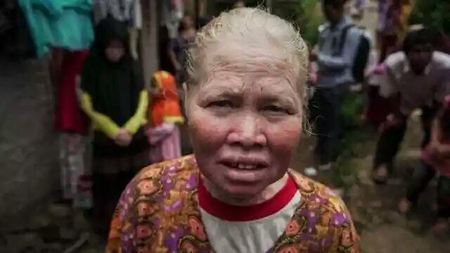 Kisah 'Walanda Sunda' di Kampung Albino Ciburuy