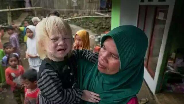 Kisah 'Walanda Sunda' di Kampung Albino Ciburuy