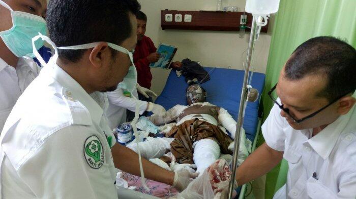 Korban Luka Bakar Dirawat ke RSUD Zainoel Abidin Bertambah