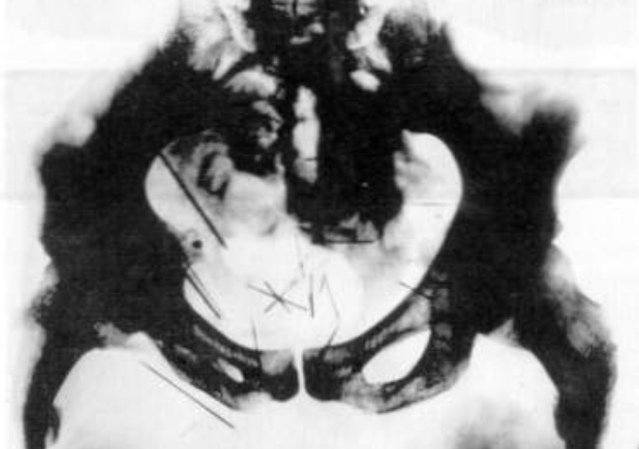 The Gray Man, Albert Fish