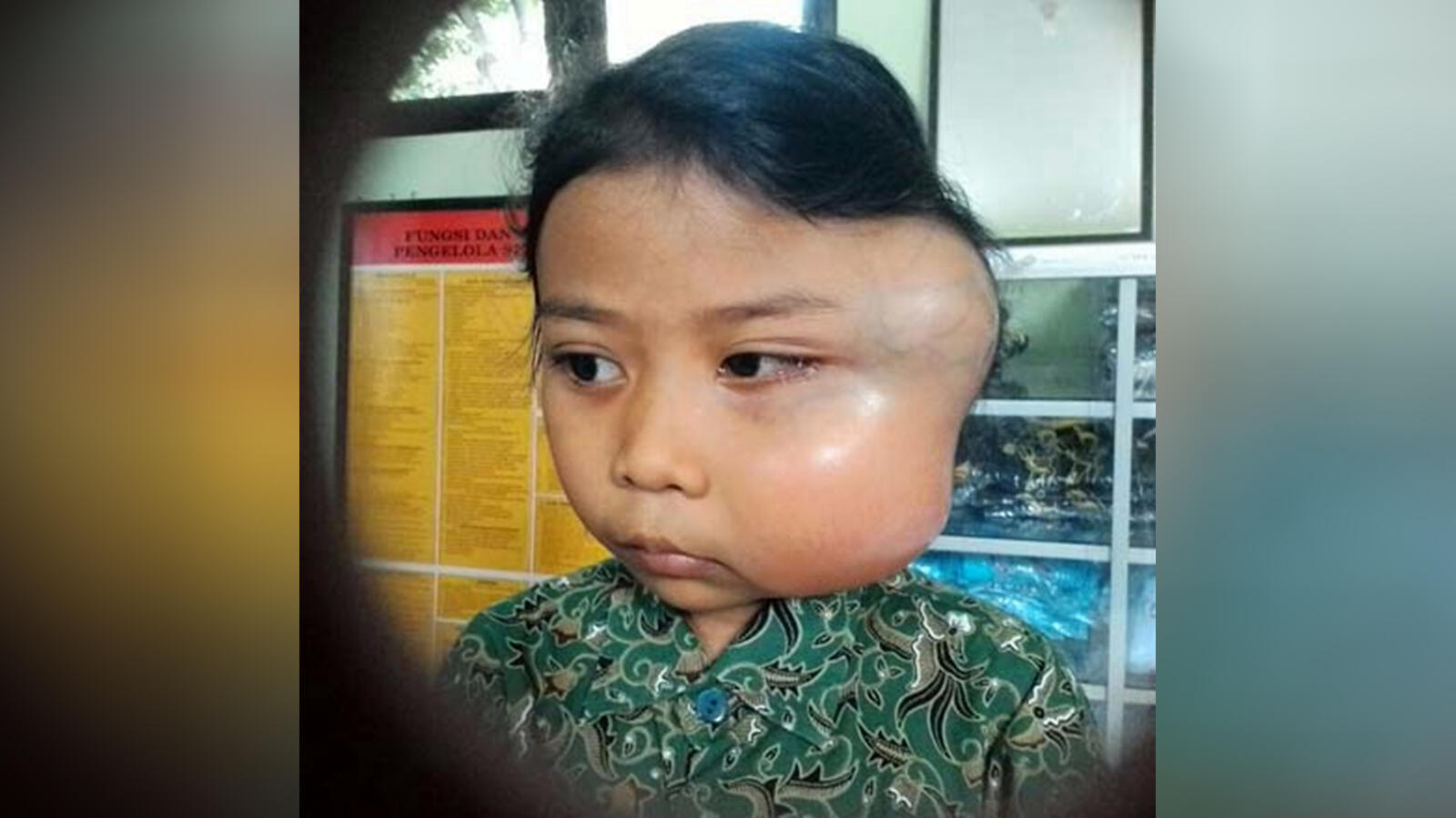 Rangkum 4 Mei 2018: Tumor Elvira hingga Aliran Dana Pendemo May Day