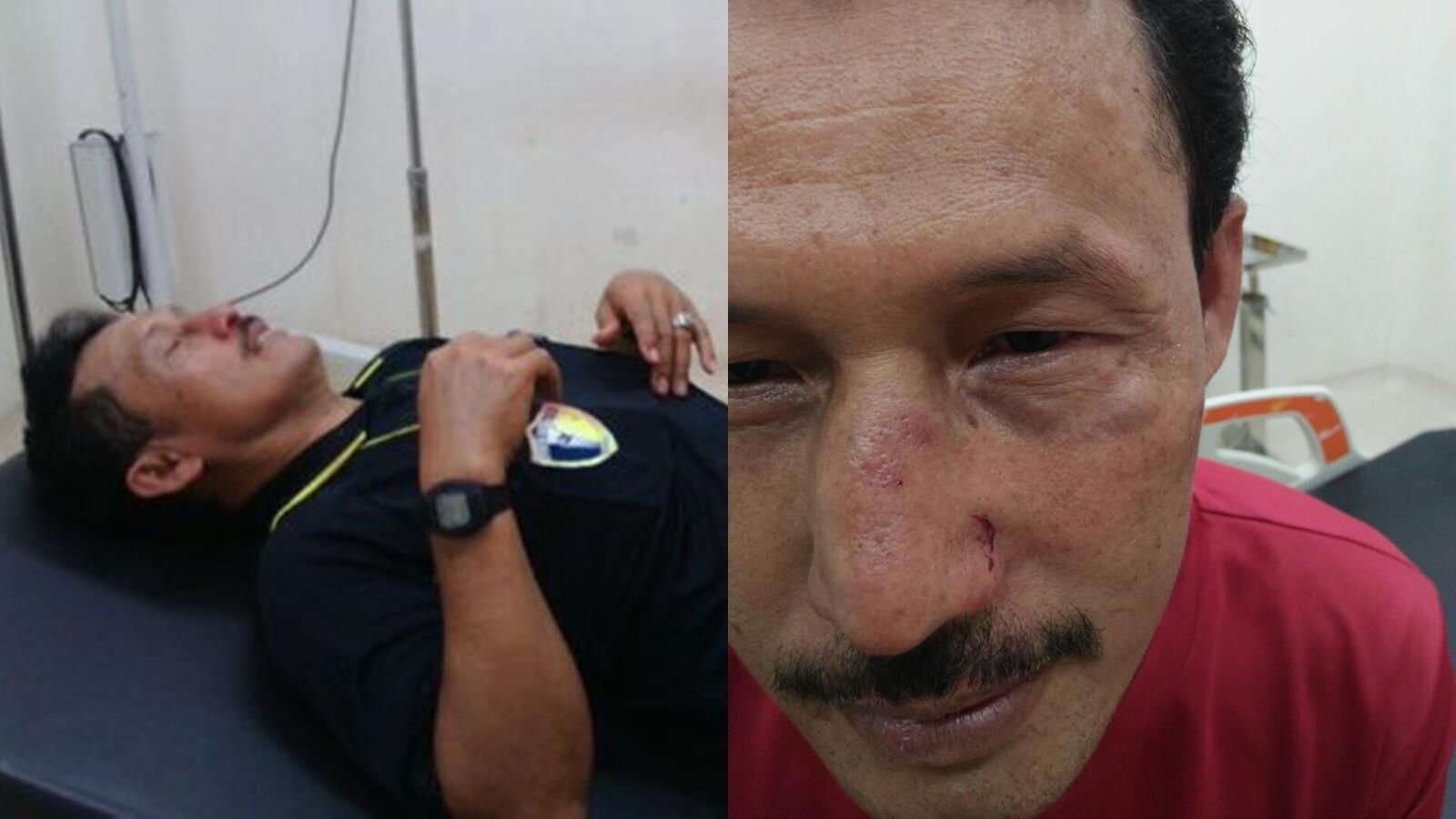 Kesaksian Amir, Wasit Liga 3 yang Dianiaya Pemain Bhayangkara Muda