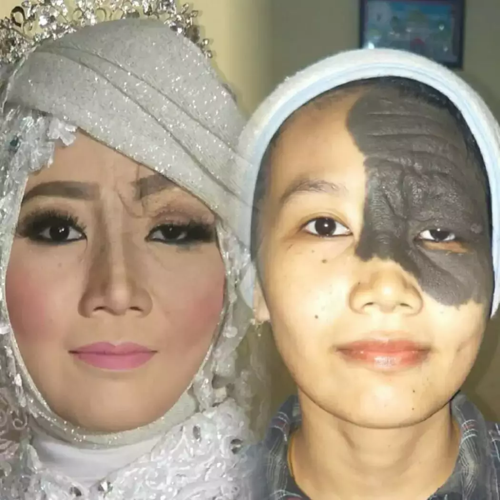 Keren. 5 Wanita Cacat Berubah Menjadi Cantik