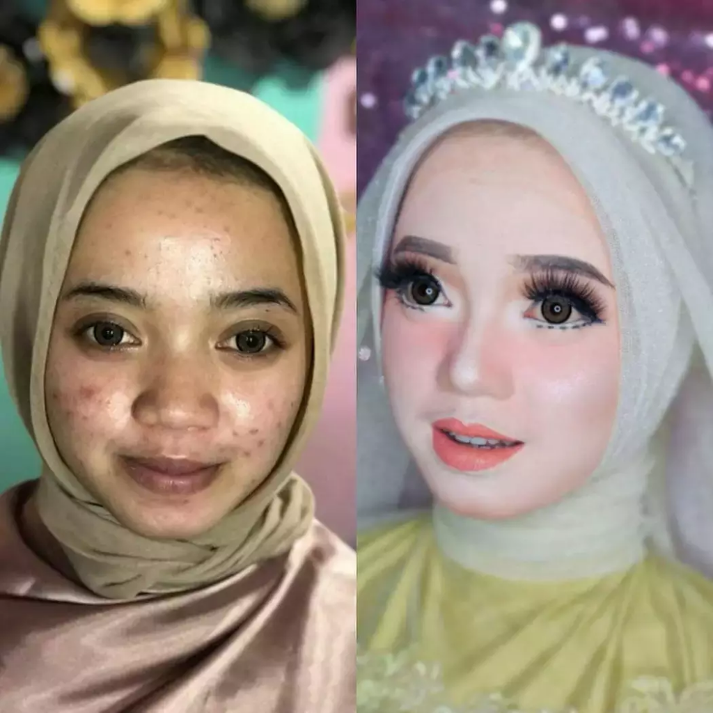 Wanita Cantik Cacat Fisik