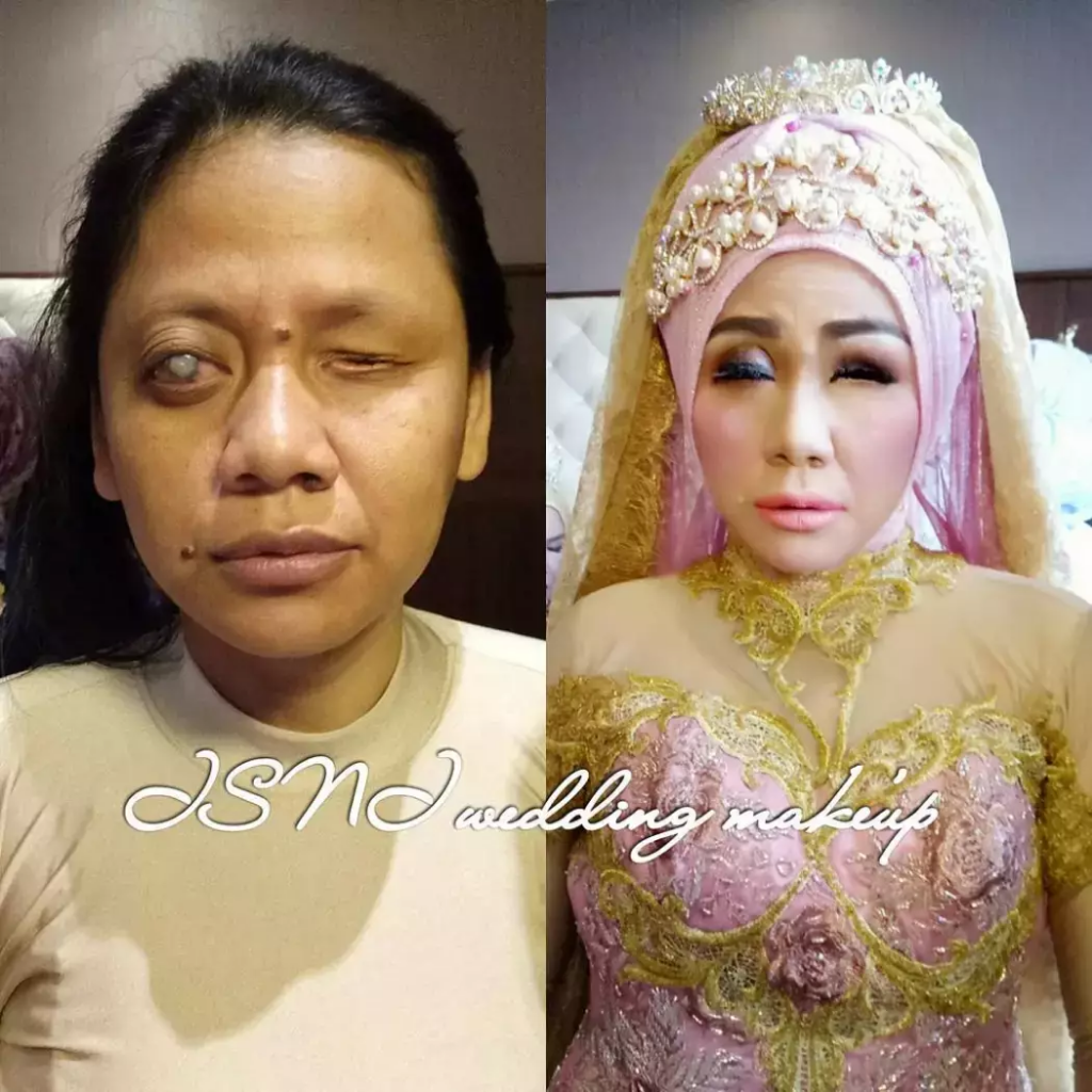 Keren. 5 Wanita Cacat Berubah Menjadi Cantik