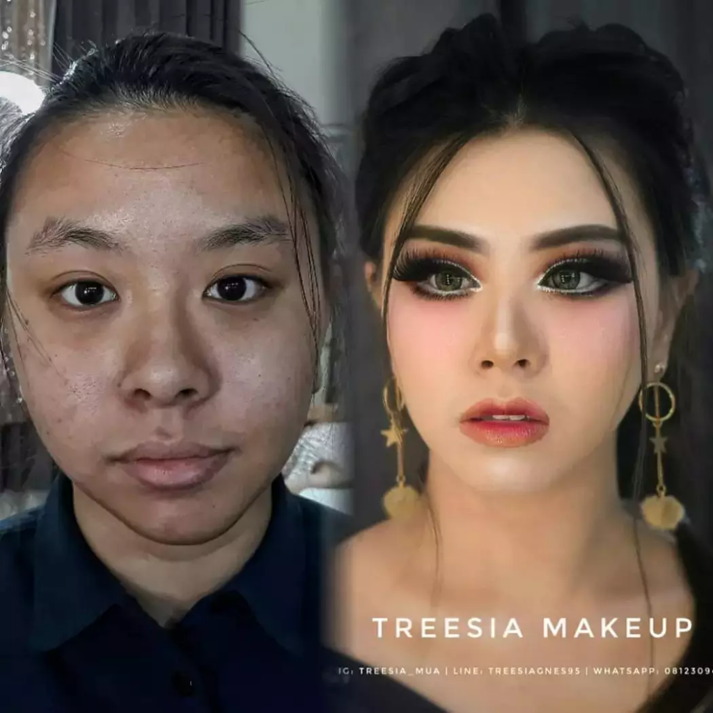 Keren. 5 Wanita Cacat Berubah Menjadi Cantik