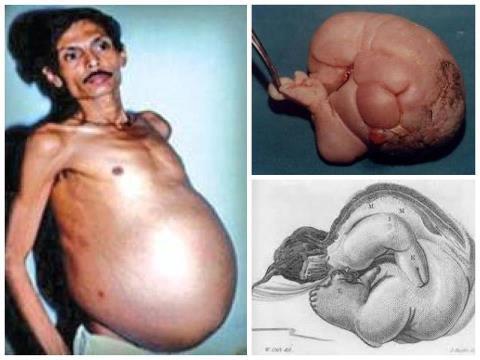 6 Manusia Dengan Keanehan Yang Di Takdirkan