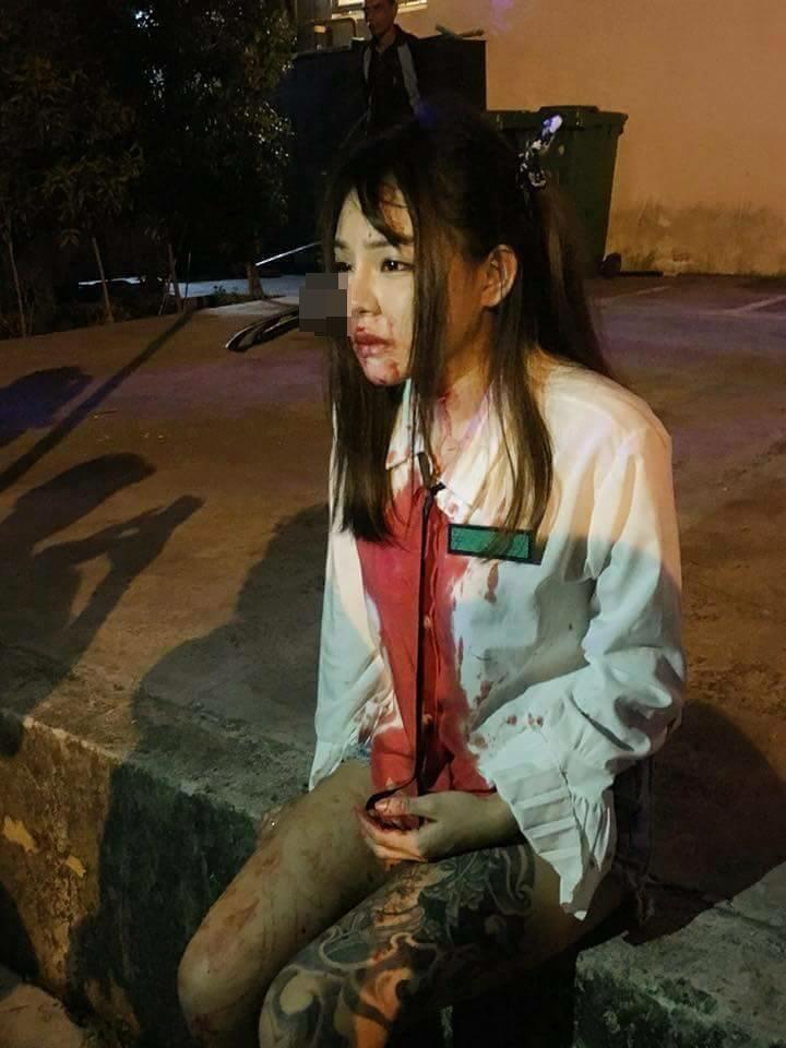 Melawan saat dicopet, wajah wanita ini berakhir mengenaskan ( DP INSIDE ! )