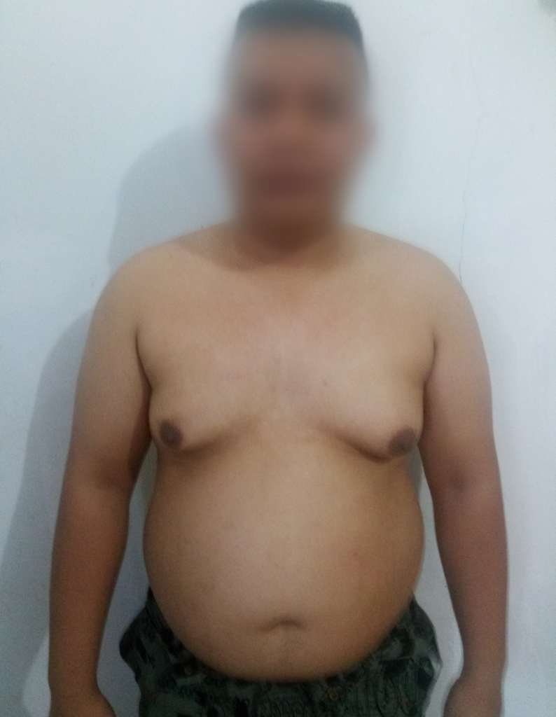 Program Ane Kurus Dalam 60 Hari Tanpa Obat