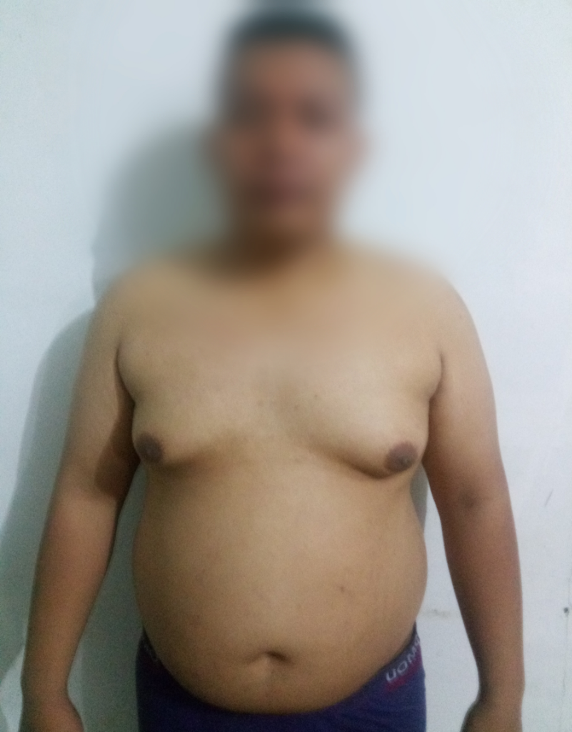 Program Ane Kurus Dalam 60 Hari Tanpa Obat