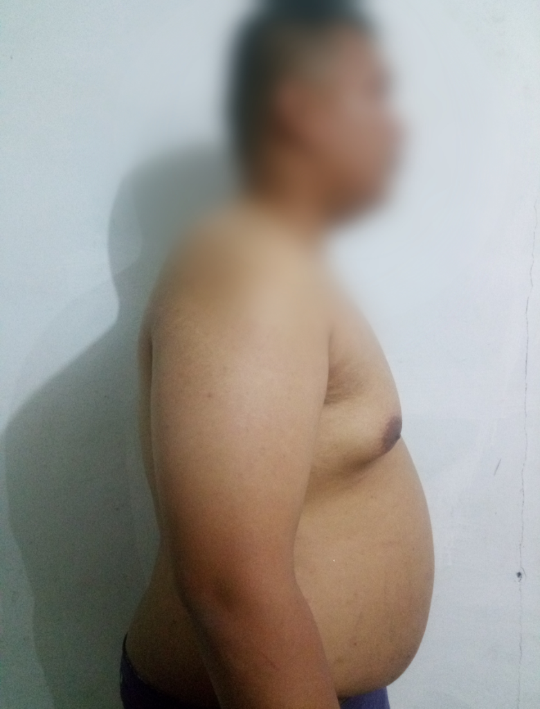 Program Ane Kurus Dalam 60 Hari Tanpa Obat