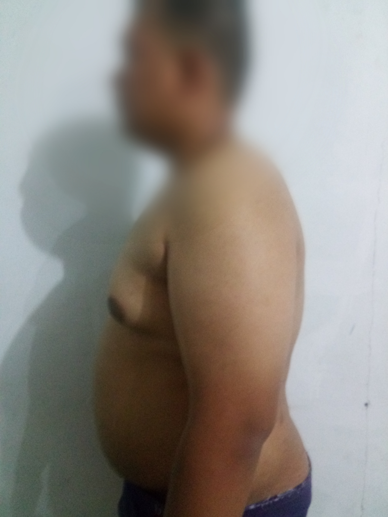 Program Ane Kurus Dalam 60 Hari Tanpa Obat