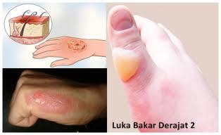Rasa Paling Sakit Yang Dirasakan Manusia, Apa Saja Itu ?