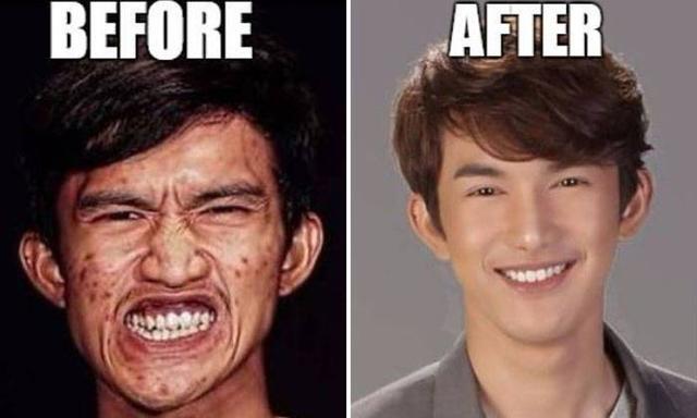 Seorang Buruh Oplas jadi Sperti Model Korea.Ibu Kndung n Pacarnya Smpai Nngis2