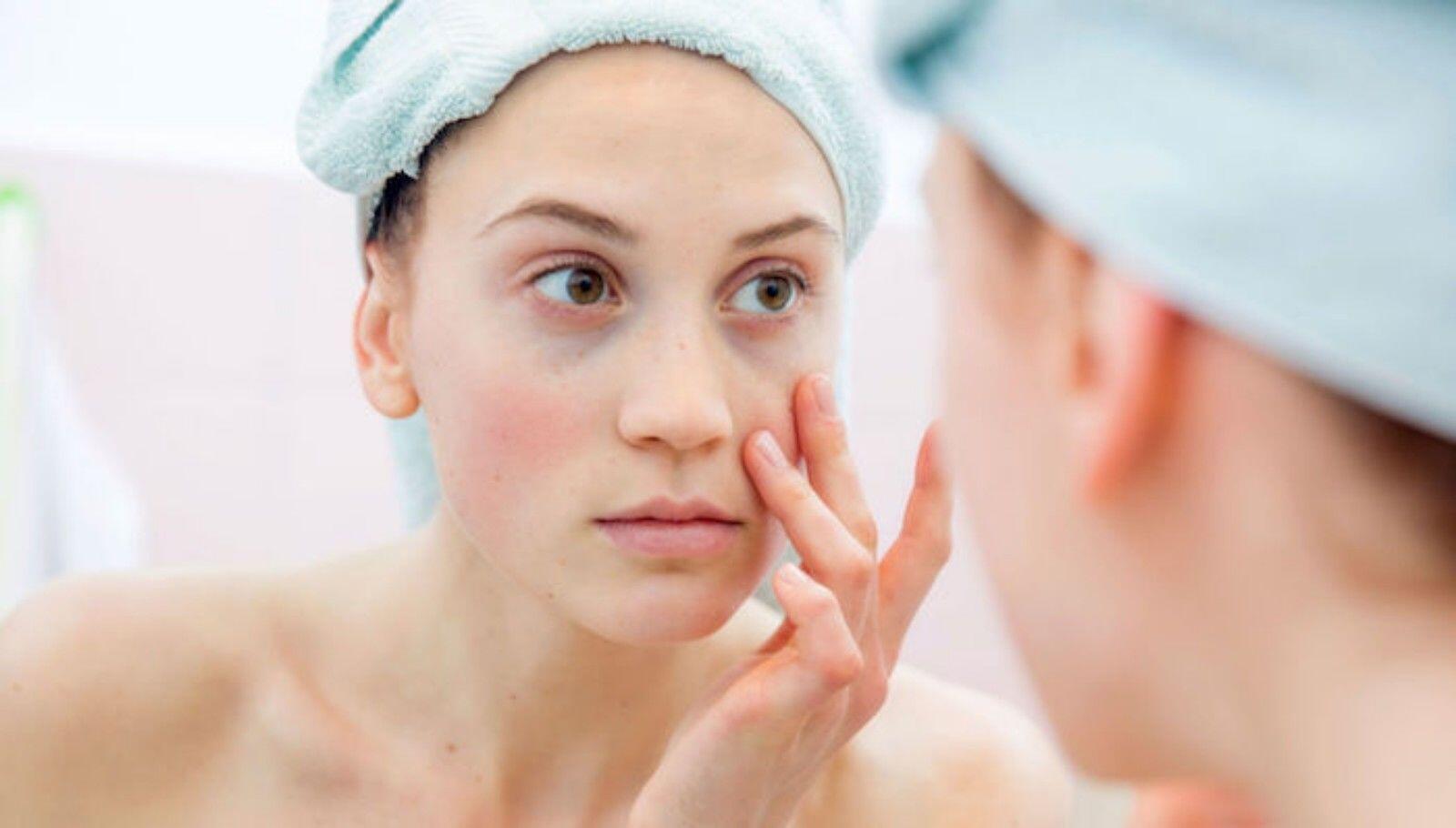 Segera Stop, Ini 7 Tanda Skincare Tak Cocok dengan Kulitmu