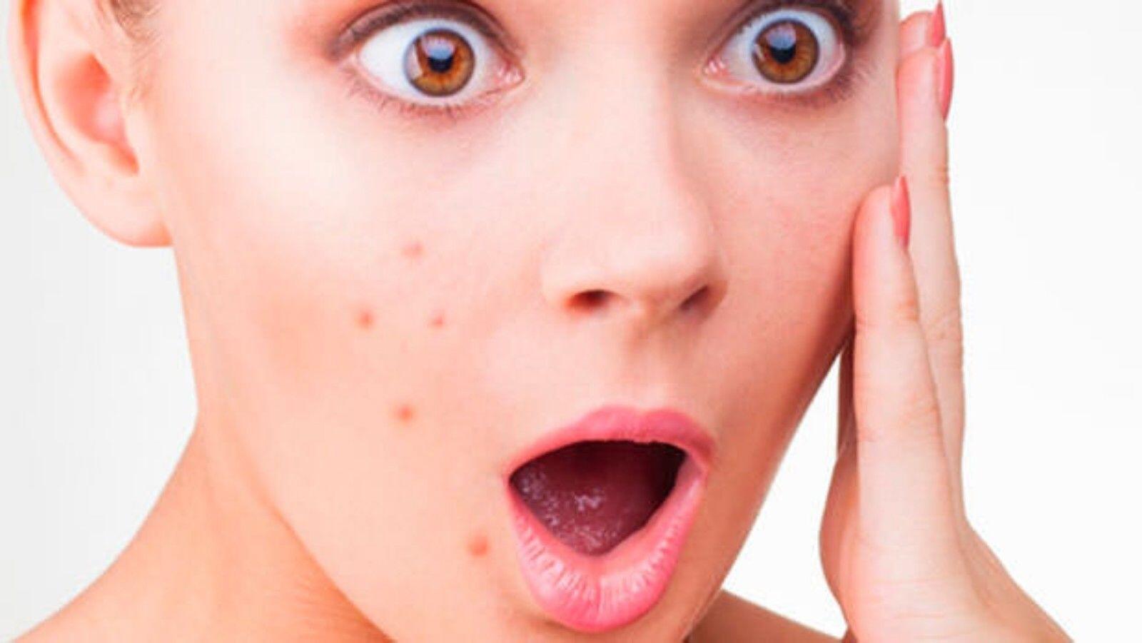 Segera Stop, Ini 7 Tanda Skincare Tak Cocok dengan Kulitmu