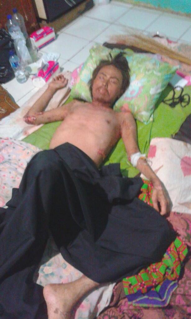 PENGGALANGAN DANA (Saudara Wardi)