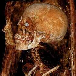 Ilmuwan Memecahkan Misteri Di Balik Mumi Menjerit