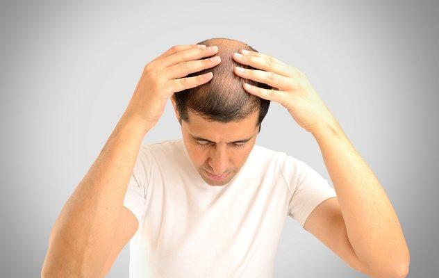 TRIKOTILOMANIA : KEBIASAAN MENCABUT RAMBUT
