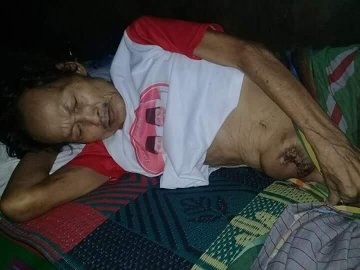 DONASI PAK PENU YANG TERKENA
PENYAKIT TUMOR DIPERUTNYA