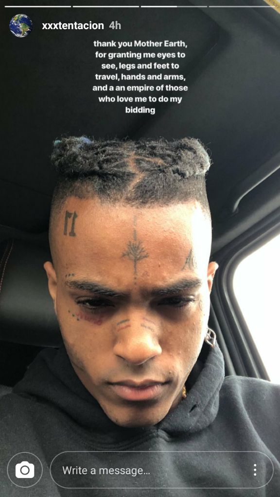 Bintang hip hop XXXTENTACION maut ditembak