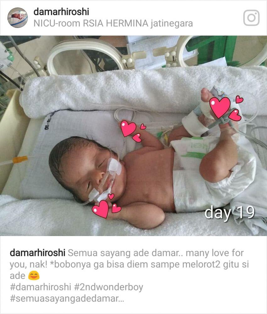 - Peduli Kasih - MARI Kita bantu adik Damar melawan penyakit langka Apert Sindrom