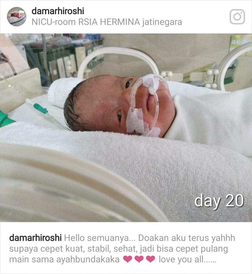 - Peduli Kasih - MARI Kita bantu adik Damar melawan penyakit langka Apert Sindrom