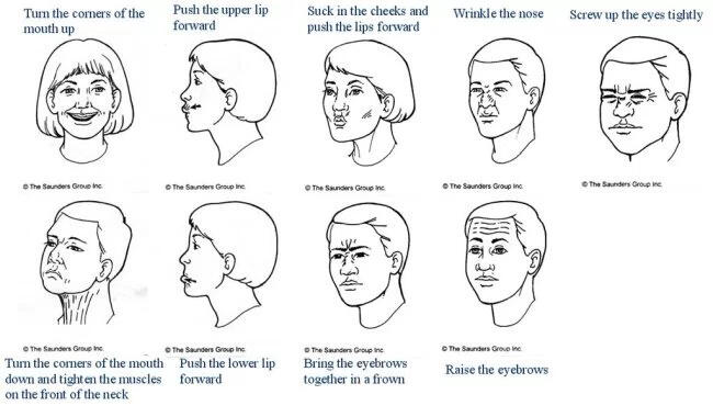 Wajah lumpuh sebelah, pengalaman Bell’s palsy