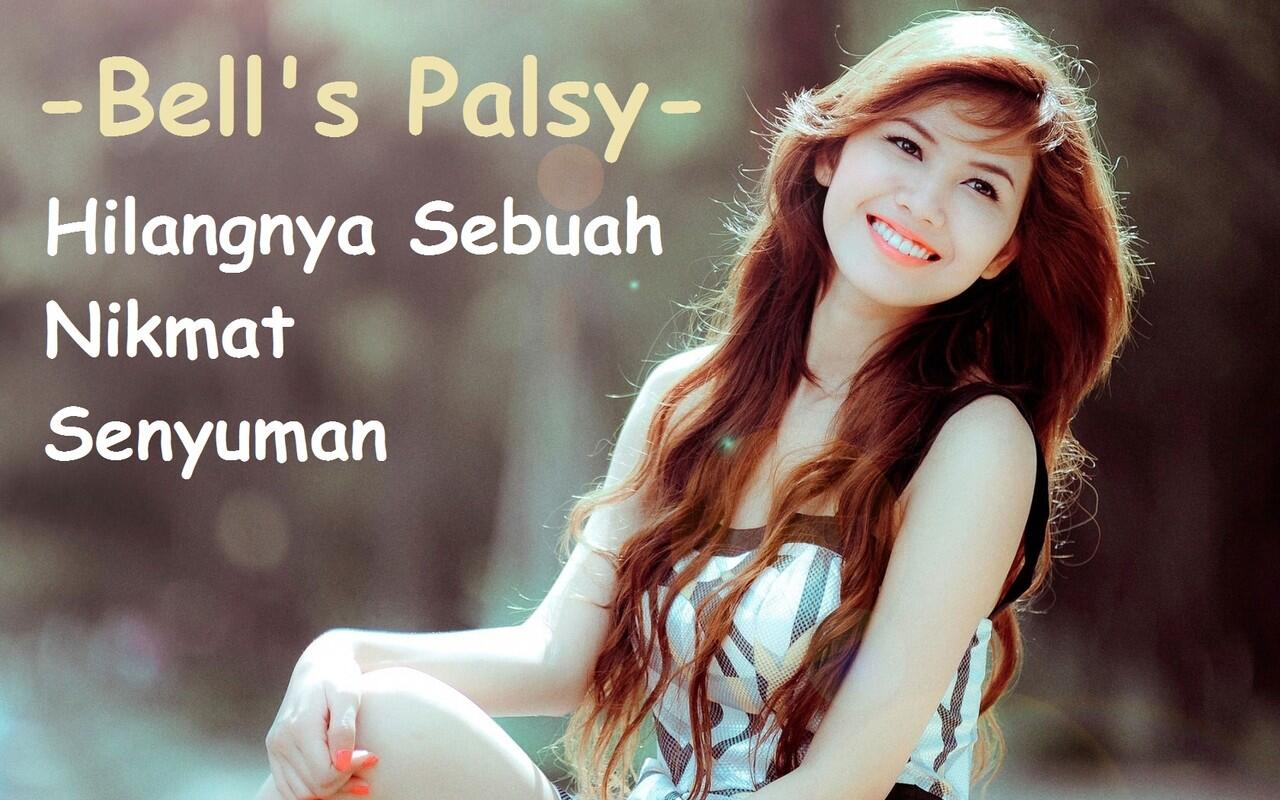 Wajah lumpuh sebelah, pengalaman Bell’s palsy