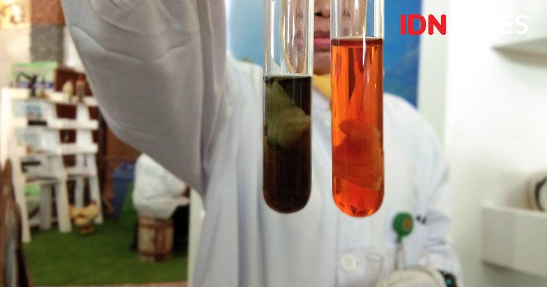 Begini Cara Bedakan Ayam Segar, Suntik, Berformalin dan Tiren