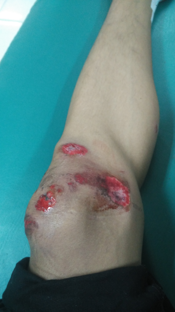 Korban Motor Lawan Arah CAKUNG