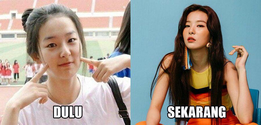 10 Bukti Kalau Idola KPop Paling Memesona Ini Pernah Alay