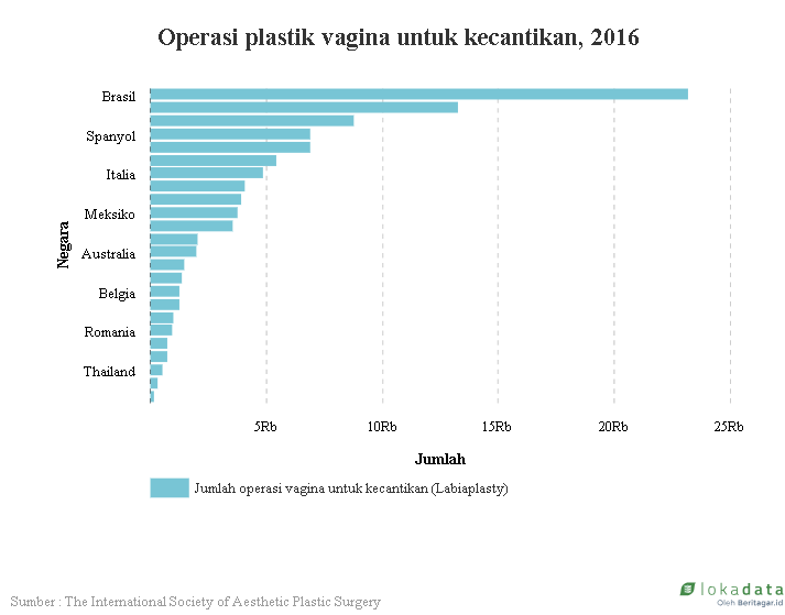 Tak ada bentuk vagina yang ideal