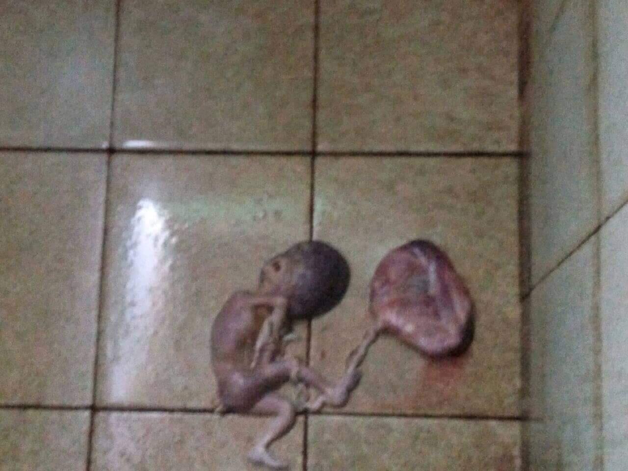 ןɐbbuıuǝɯ ɥɐןǝʇ buɐʎ ıʎɐq