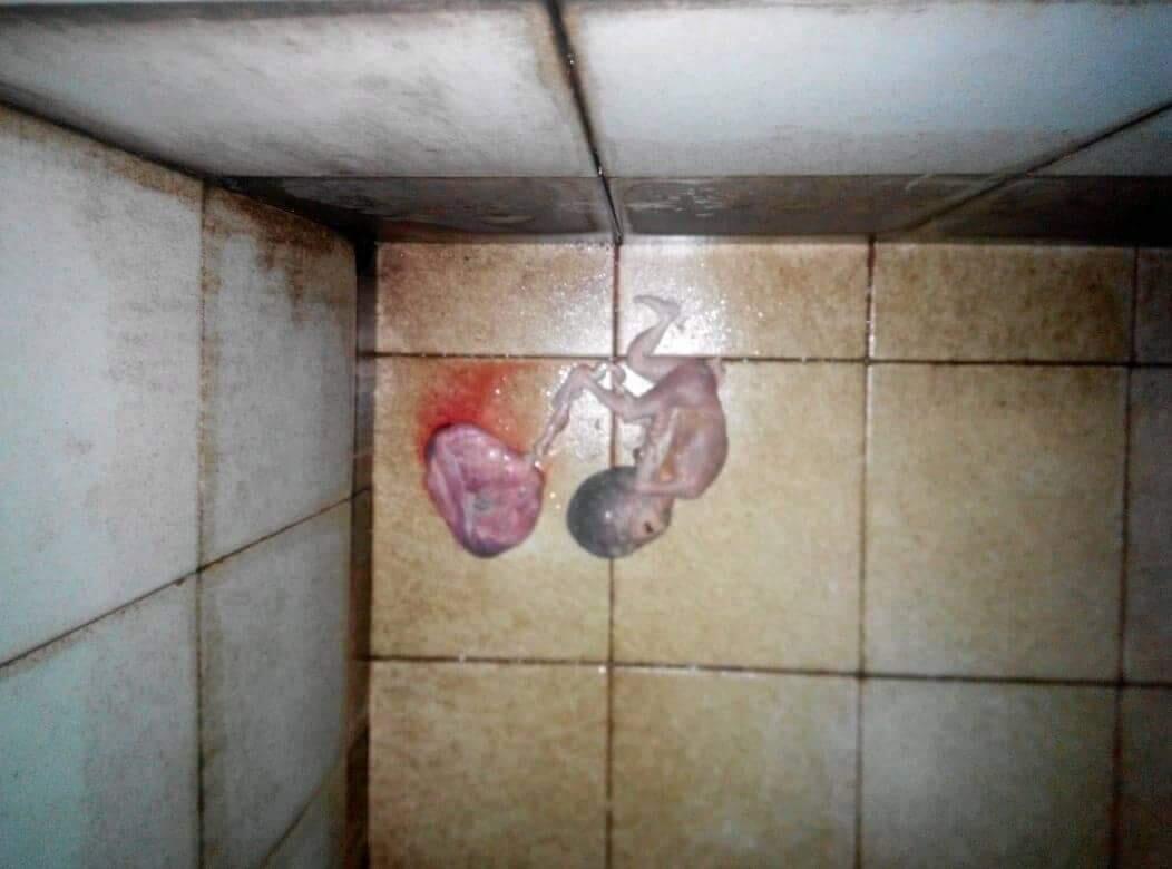 ןɐbbuıuǝɯ ɥɐןǝʇ buɐʎ ıʎɐq