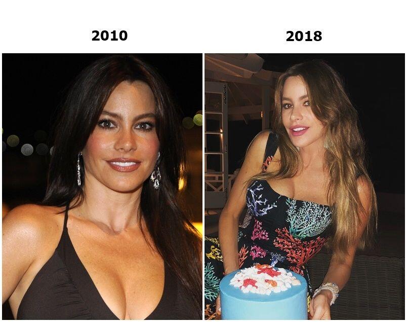Sepuluh Tahun Berlalu, Wajah 10 Artis Hollywood Ini Gak Menua, Takjub!