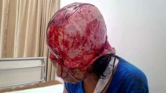 Cepet Sembuh Cantik :(