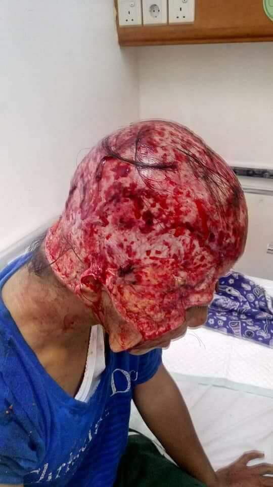 Cepet Sembuh Cantik :(