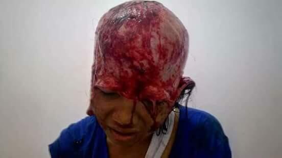 Cepet Sembuh Cantik :(