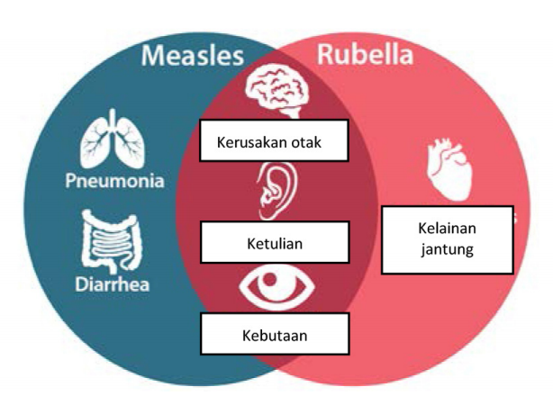 Negara dengan Kasus Campak Terbanyak di Dunia 2016: Indonesia Ranking 6!!