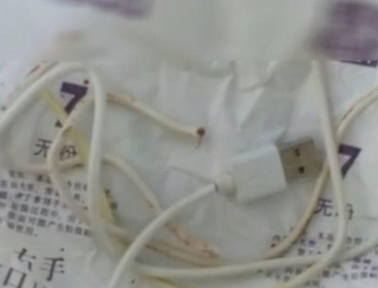 Duh! Seorang anak 13 tahun memasukkan kabel USB ke dalam genitalnya