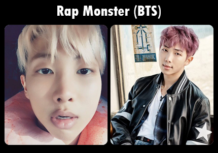 5 Artis Kpop Yang Sangat Sukses Meskipun Memiliki Kekurangan Fisik