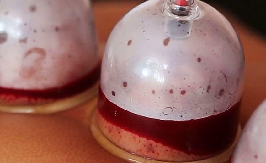 7 Manfaat Luar Biasa Bekam yang Mungkin Belum Kamu Tahu