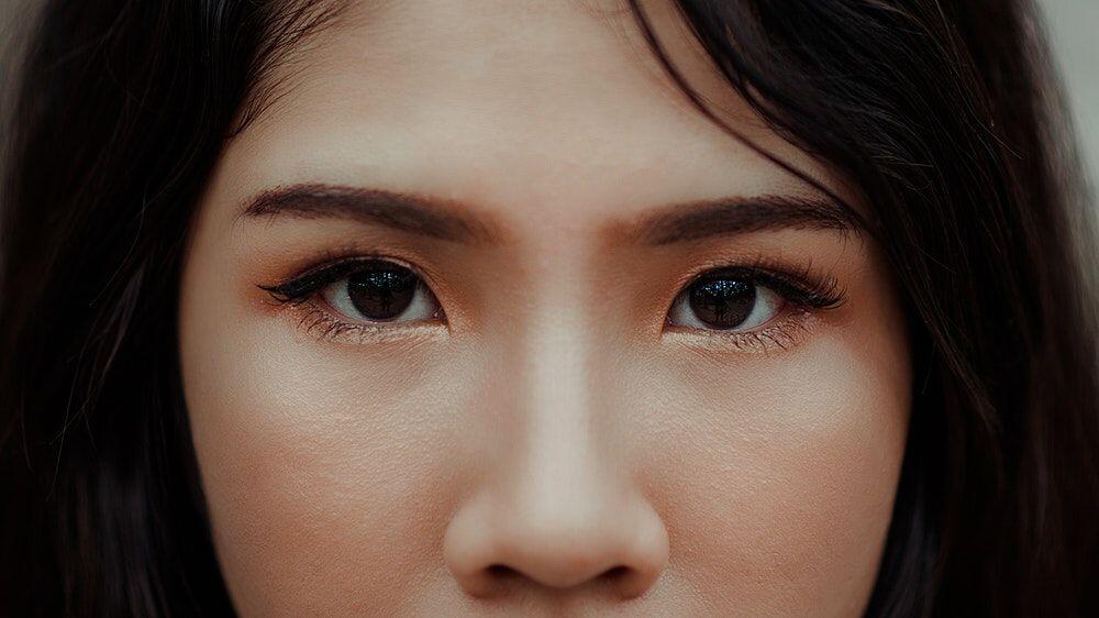 7 Cara Hilangkan Jerawat dengan Cara Alami, Dijamin Gak Iritasi