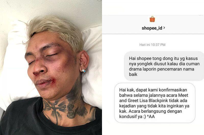 Young Lex Ngaku Dipukul Oknum Fans KPop, Ini Klarifikasi Shopee