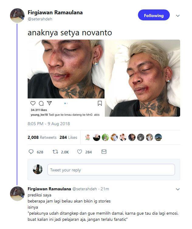 Young Lex Ngaku Dipukul Oknum Fans KPop, Ini Klarifikasi Shopee