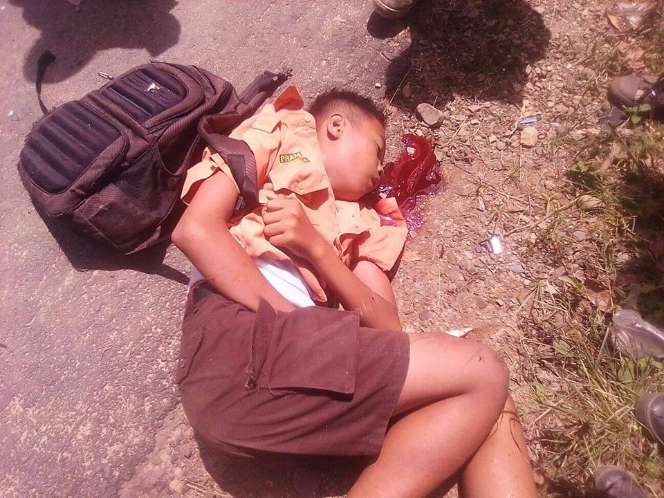 Anak SD