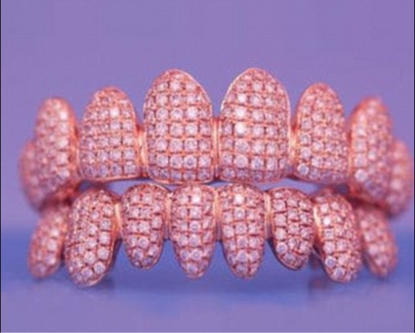 Rapper Ini Habiskan Rp445 Juta untuk Pasang 500 Berlian di Gigi